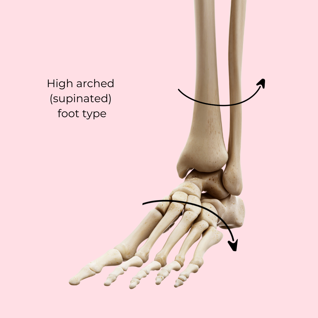 High 2025 arch supination